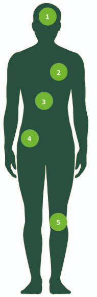 Image of the body showing numbered areas where critical illness could occur.